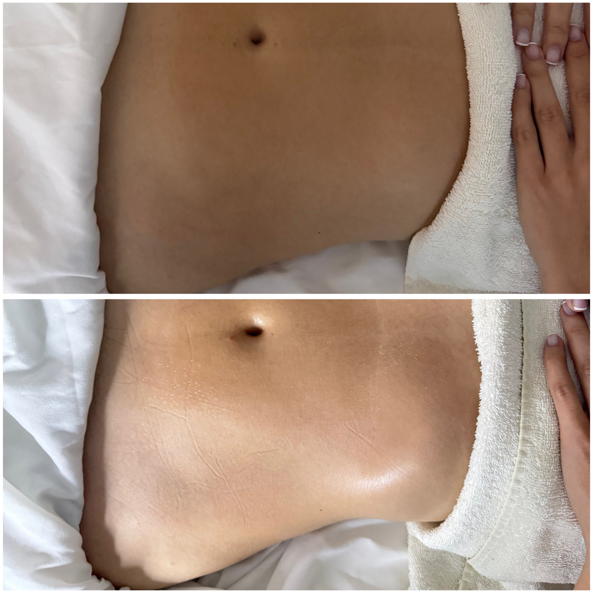 Full-Body Brazilian Lymphatic Drainage Treatment